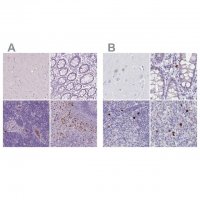 Anti-CXCR2 antibody produced in rabbit 