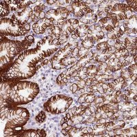 Anti-CYB561A3 antibody produced in rabbit HPA052548-100UL