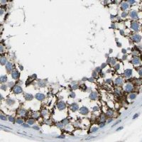 Anti-CYB5R1 antibody produced in rabbit HPA014147-100UL