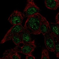 Anti-CYGB antibody produced in rabbit HPA017757-100UL