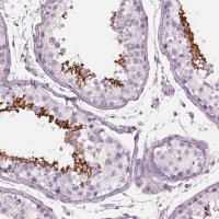 Anti-CYLC1 antibody produced in rabbit 