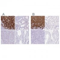 Anti-CYP21A2 antibody produced in rabbit 