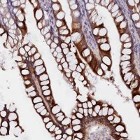 Anti-CYP2D6 antibody produced in rabbit 