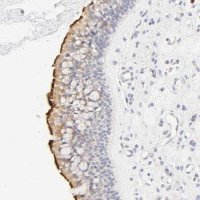 Anti-CYP4B1 antibody produced in rabbit HPA004331-100UL