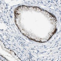 Anti-CYP4X1 antibody produced in rabbit 
