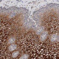 Anti-CYSRT1 antibody produced in rabbit 