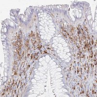 Anti-DAB2 antibody produced in rabbit 