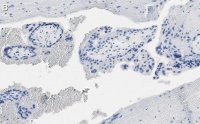 Anti-DAP Kinase 1 Antibody, clone 1J22 ZooMAb Rabbit Monoclonal 