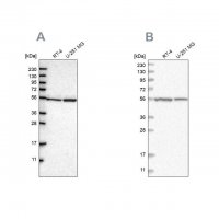 Anti-DARS antibody produced in rabbit HPA020451-100UL