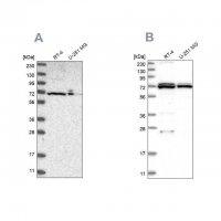 Anti-DARS2 antibody produced in rabbit 