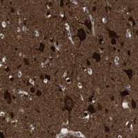 Anti-DCLK1 antibody produced in rabbit 