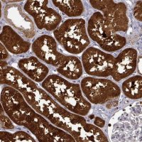Anti-DDC antibody produced in rabbit HPA017742-100UL