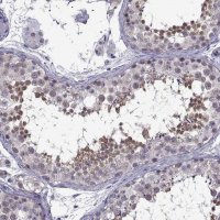 Anti-DDX20 antibody produced in rabbit 