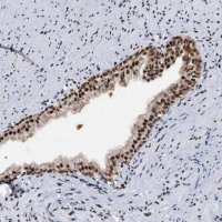 Anti-DDX23 antibody produced in rabbit 