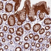 Anti-DDX28 antibody produced in rabbit 
