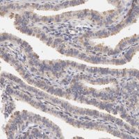 Anti-DDX3X antibody produced in rabbit 