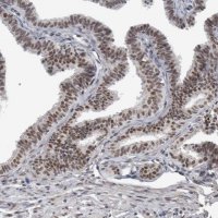 Anti-DDX42 antibody produced in rabbit 