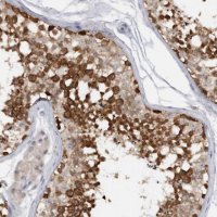 Anti-DDX43 antibody produced in rabbit 