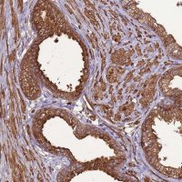 Anti-DDX59 antibody produced in rabbit 