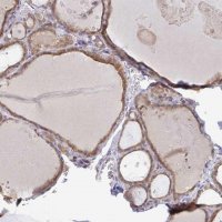 Anti-DERL2 antibody produced in rabbit 