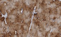 Anti-Desmin Antibody, clone 1H16, ZooMAb Rabbit Monoclonal 