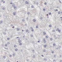 Anti-DGCR14 antibody produced in rabbit HPA001222-100UL