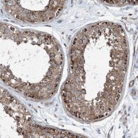 Anti-DGUOK antibody produced in rabbit HPA034766-100UL
