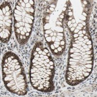 Anti-DHRS7B antibody produced in rabbit 