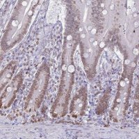 Anti-DHX37 antibody produced in rabbit 