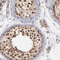 Anti-DIABLO antibody produced in rabbit 