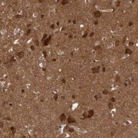 Anti-DIP2C antibody produced in rabbit 