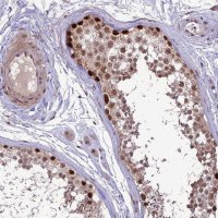Anti-DIS3 antibody produced in rabbit 