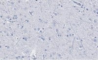 Anti-DKK3 Antibody, clone 3H17 ZooMAb Rabbit Monoclonal 
