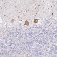 Anti-DKK4 antibody produced in rabbit HPA052916-100UL