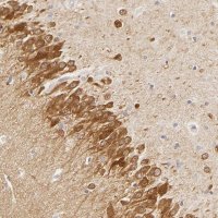 Anti-DLG3 antibody produced in rabbit 