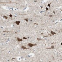 Anti-DLG4 antibody produced in rabbit 
