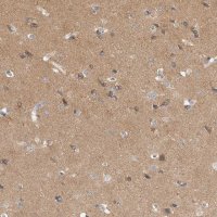 Anti-DLGAP3 antibody produced in rabbit 