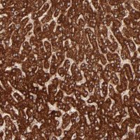 Anti-DLST antibody produced in rabbit 