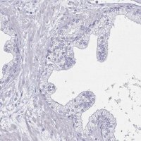 Anti-DMRTB1 antibody produced in rabbit 