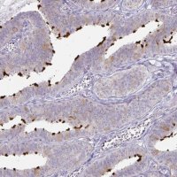 Anti-DNAH9 antibody produced in rabbit 