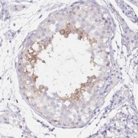 Anti-DNAI2 antibody produced in rabbit 