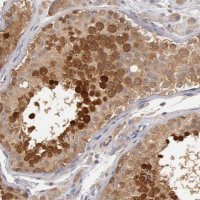 Anti-DNAJA1 antibody produced in rabbit HPA001306-100UL