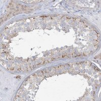 Anti-DNAJC18 antibody produced in rabbit 