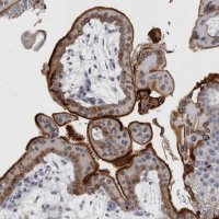 Anti-DNAJC24 antibody produced in rabbit HPA025237-100UL