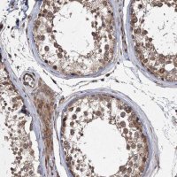 Anti-DNAJC27 antibody produced in rabbit 