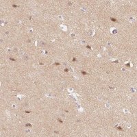 Anti-DNAJC6 antibody produced in rabbit 