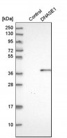 Anti-DNASE1 antibody produced in rabbit 