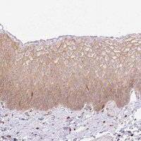 Anti-DNM2 antibody produced in rabbit HPA054246-100UL