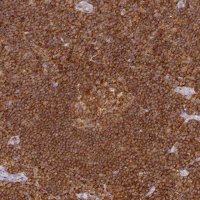 Anti-DOCK2 antibody produced in rabbit HPA036469-100UL