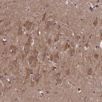 Anti-DOHH antibody produced in rabbit 